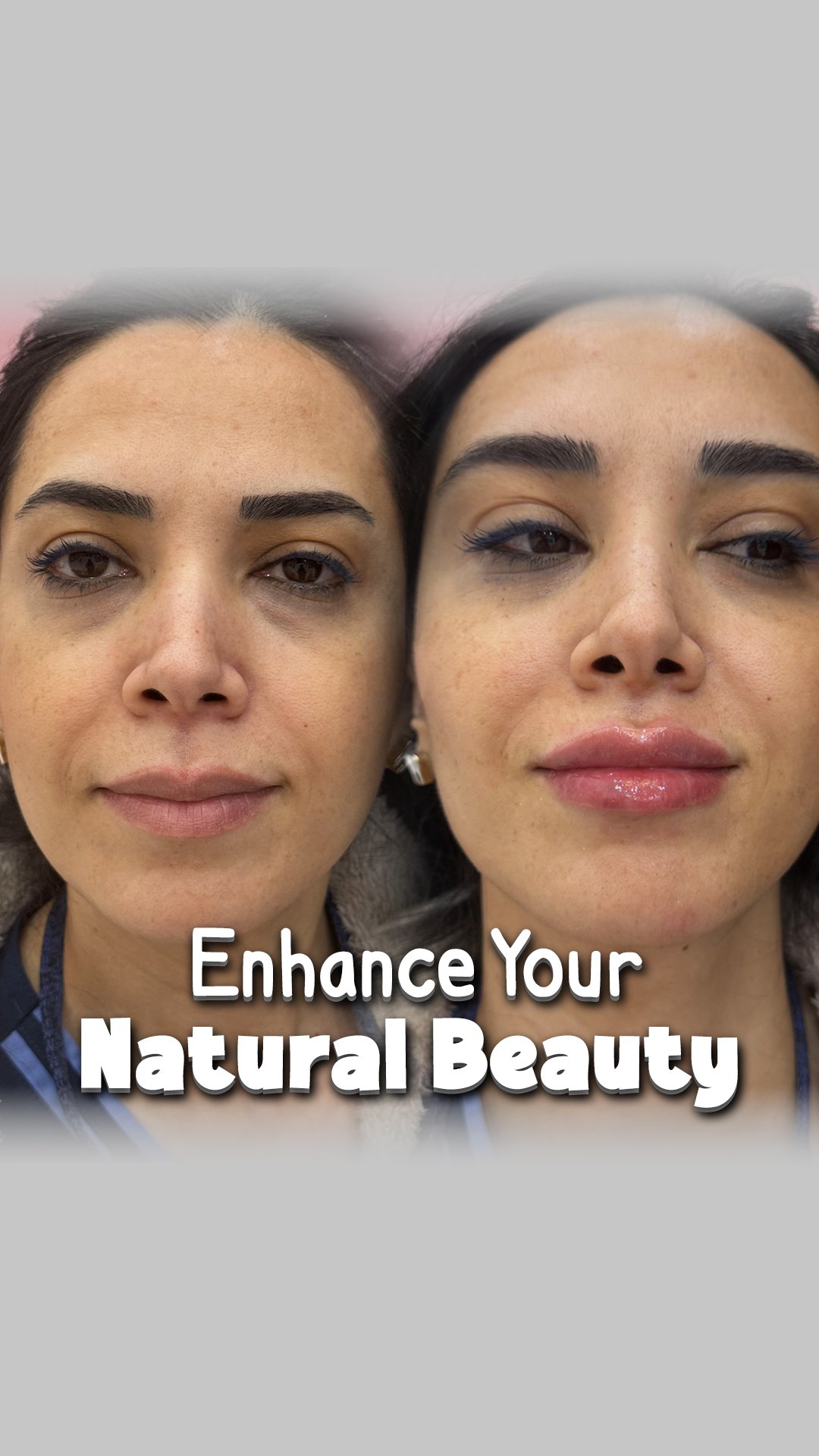 Enhance Your Natural Beauty