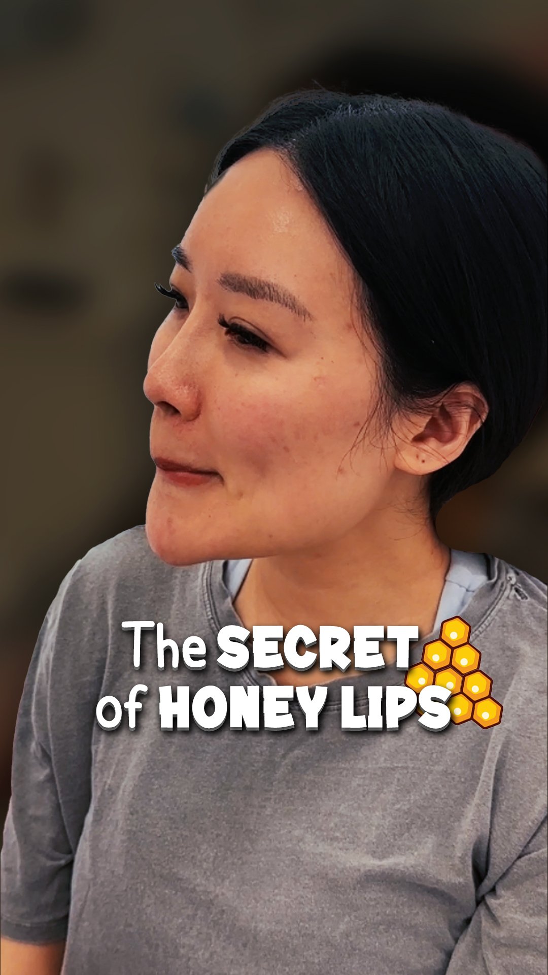 Honey Lips with lip filler