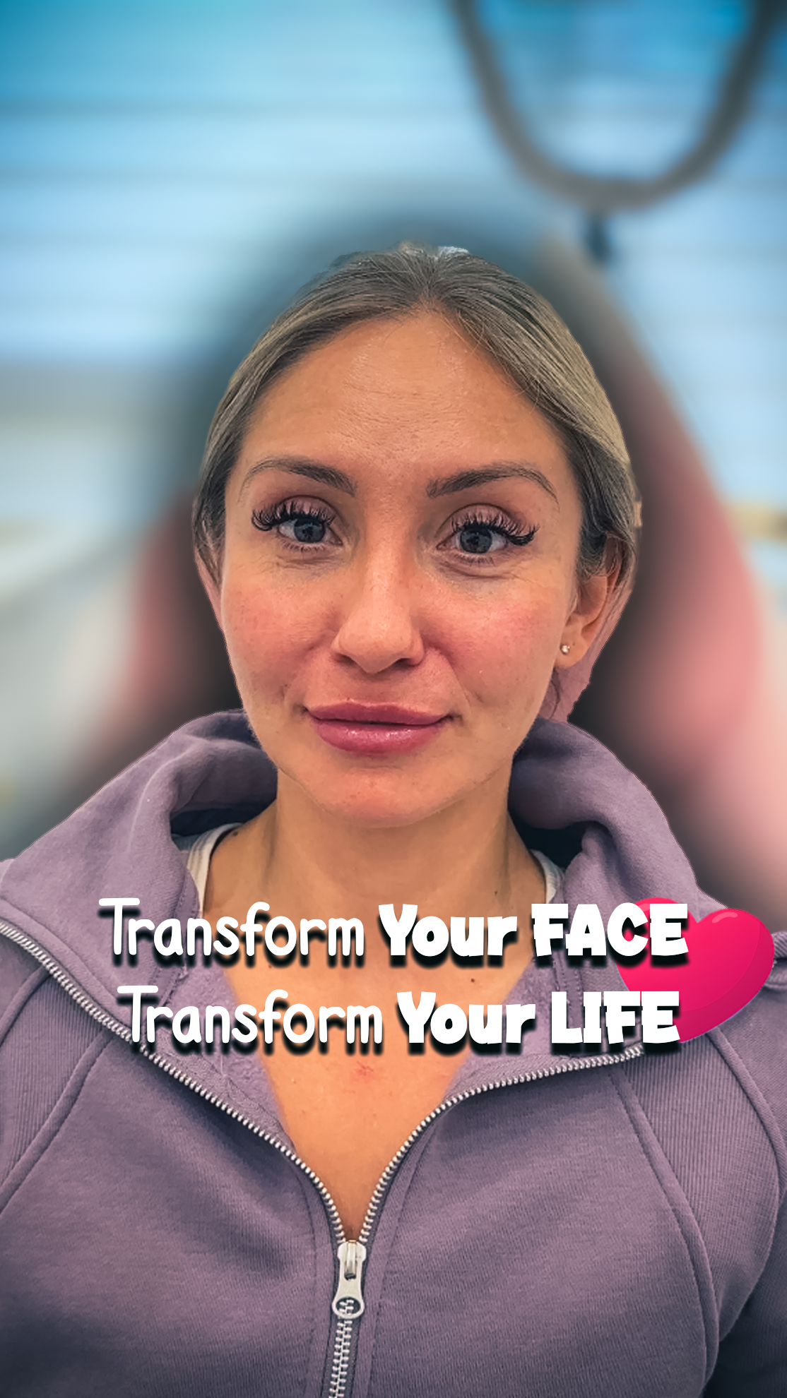 transform your face - transform your life - lip filler - nose filler 