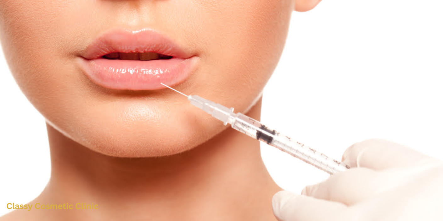 after filler care Best cosmetic treatments Markham