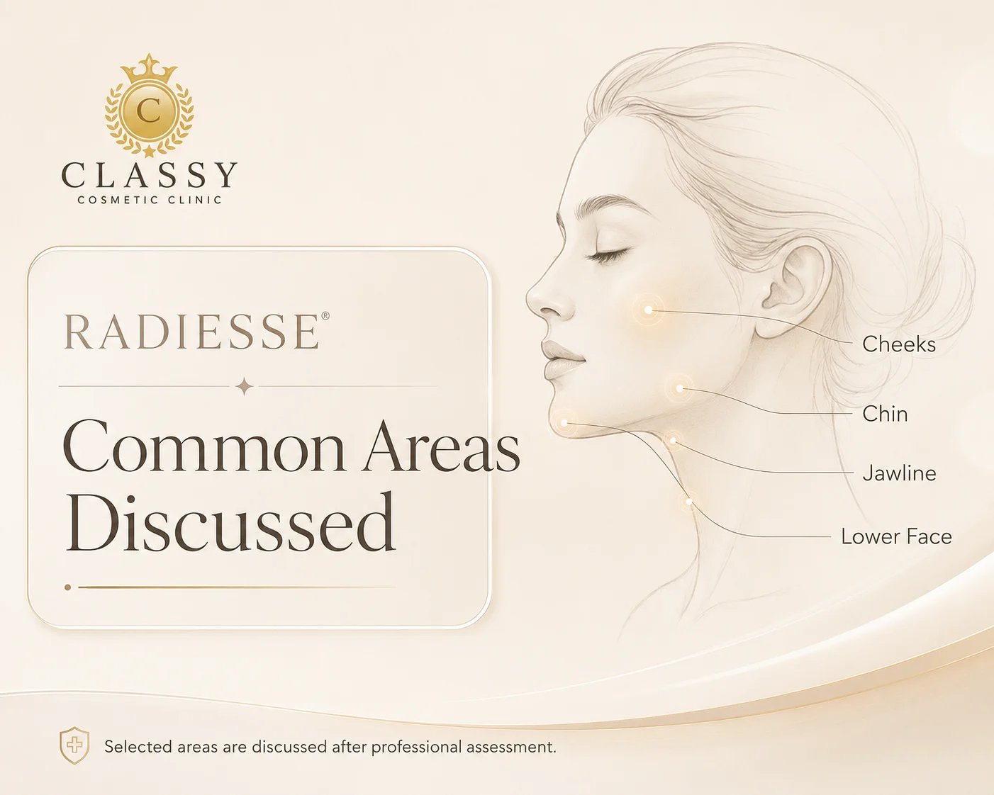 Radiesse common treatment areas discussed at Classy Cosmetic Clinic including cheeks, chin, jawline, and lower face after professional assessment