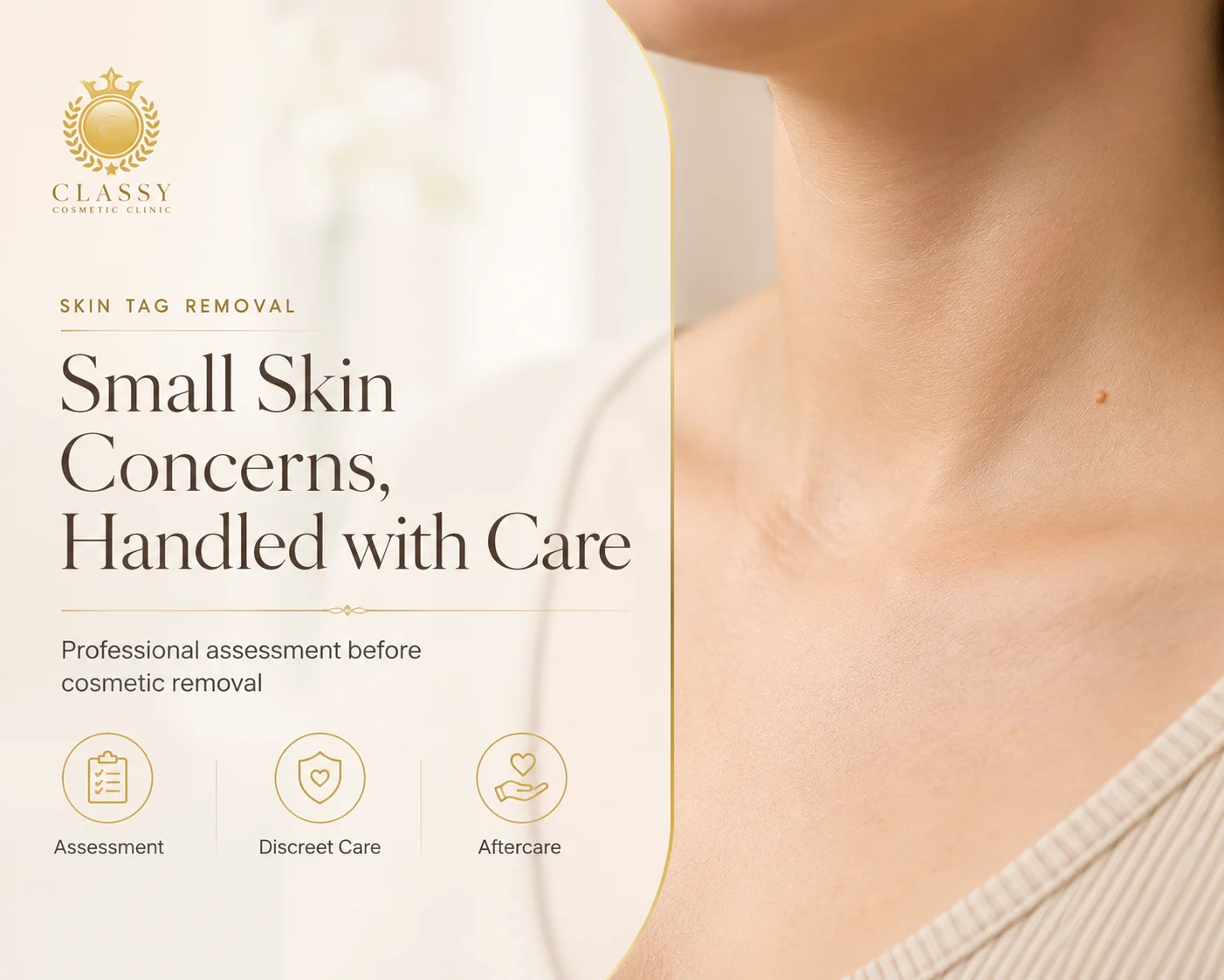 Premium beige website graphic introducing skin tags as small visible skin concerns with a clean, non-graphic design.